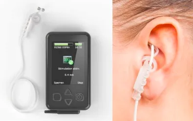 TVNS-L-Vagus-nerve-stimulator